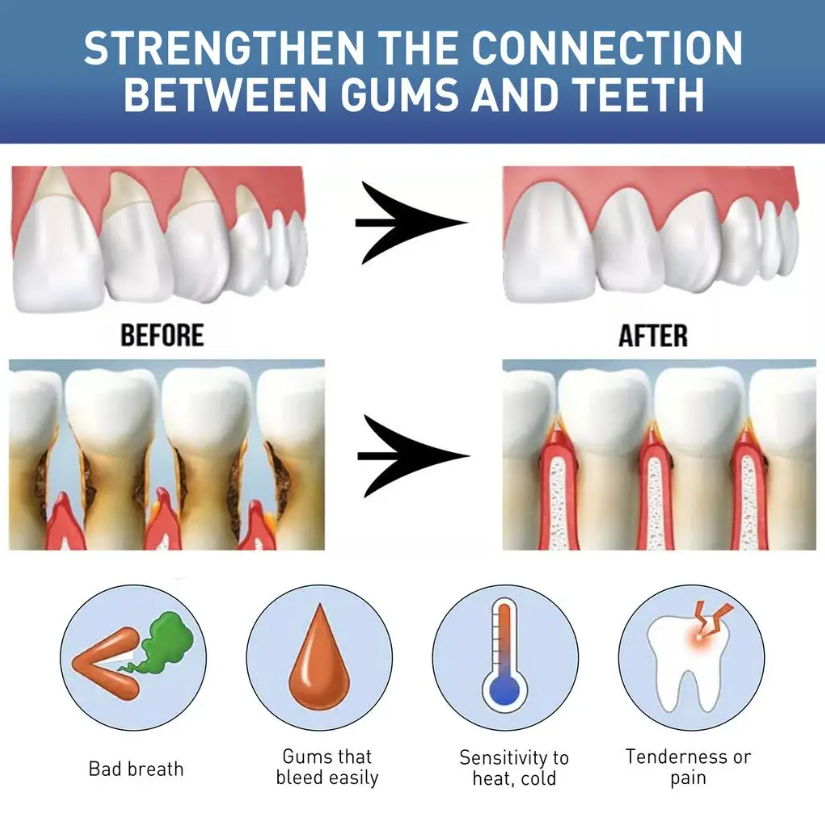 Жидкость для ежедневного ухода – обзор и цена Teeth Whitening Naturally