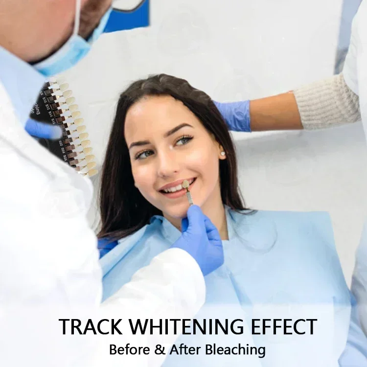 Профессиональные отбеливающие  – обзор и цена Teeth Whitening Shade Guide