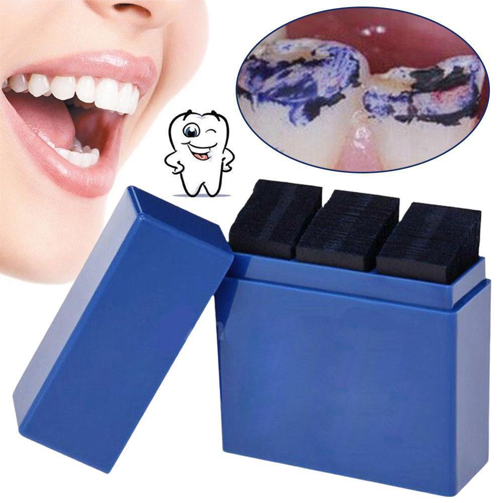 300 листов артикуляционной бум – обзор и цена Teeth Whitening Professional