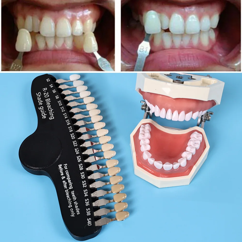 ELIJAH R-20 Руководство по отб – обзор и цена Teeth Whitening Shade Guide